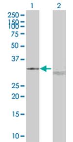 UCP2 Polyclonal Antibody, MaxPab™