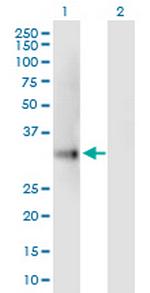 UCP2 Polyclonal Antibody, MaxPab™