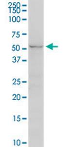 UGT2B7 Monoclonal Antibody (8D12)