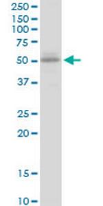 UGT2B15 Polyclonal Antibody, MaxPab™