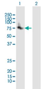 UMOD Antibody in Western Blot (WB)