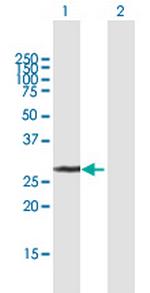 UCK2 Polyclonal Antibody, MaxPab™