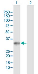 UCK2 Polyclonal Antibody, MaxPab™