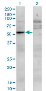 UMPS Monoclonal Antibody (2F5)