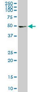 UMPS Monoclonal Antibody (2B10)