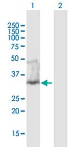UNG Polyclonal Antibody, MaxPab™