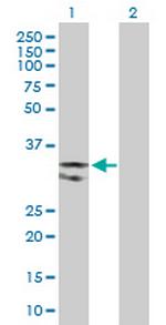 UNG Polyclonal Antibody, MaxPab™