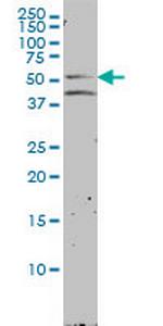 NR1H2 Monoclonal Antibody (2H2-H3)