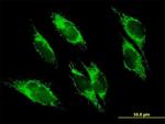 UQCRC1 Polyclonal Antibody, MaxPab™