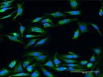 UQCRC2 Polyclonal Antibody, MaxPab™