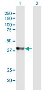 UROD Polyclonal Antibody, MaxPab™