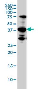UROD Antibody in Western Blot (WB)