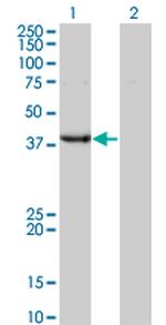UROD Antibody in Western Blot (WB)