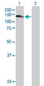 USP1 Antibody in Western Blot (WB)