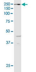 KDM6A Monoclonal Antibody (4E7)