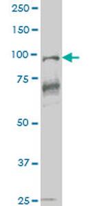 VAV1 Antibody in Western Blot (WB)
