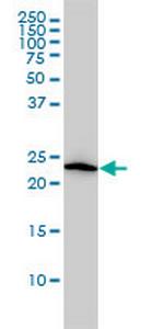 VBP1 Monoclonal Antibody (3D11)