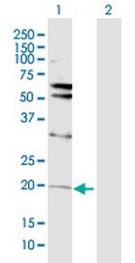 VHL Polyclonal Antibody, MaxPab™