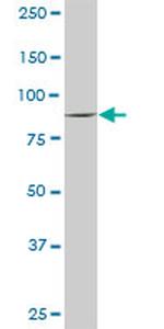 VIL1 Antibody in Western Blot (WB)