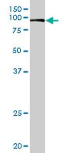 VIL1 Antibody in Western Blot (WB)