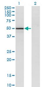 VIL1 Monoclonal Antibody (2F10)