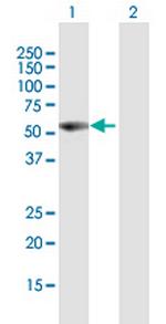 VIM Antibody in Western Blot (WB)