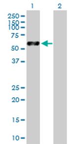 VIM Antibody in Western Blot (WB)