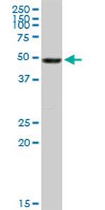 VIM Antibody in Western Blot (WB)