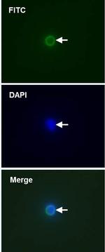 Cell-Surface Vimentin (CSV) Antibody in Immunocytochemistry (ICC/IF)