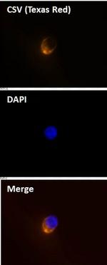 Cell-Surface Vimentin (CSV) Antibody in Immunocytochemistry (ICC/IF)