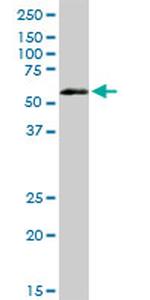 VRK2 Antibody in Western Blot (WB)