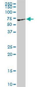 VRK2 Antibody in Western Blot (WB)