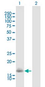 VSNL1 Antibody in Western Blot (WB)