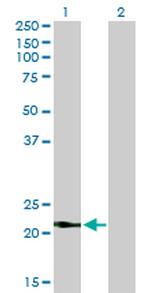 VSNL1 Monoclonal Antibody (2F1-E3)