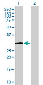 VWF Antibody in Western Blot (WB)