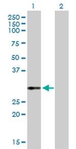 VWF Antibody in Western Blot (WB)