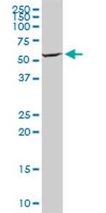 WARS Antibody in Western Blot (WB)