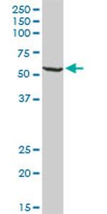 WARS Antibody in Western Blot (WB)
