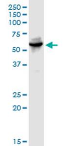 WARS Antibody in Western Blot (WB)