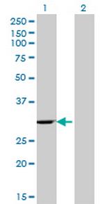 WBSCR1 Monoclonal Antibody (4B2)