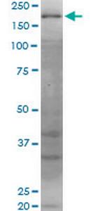 WRN Monoclonal Antibody (2F7)