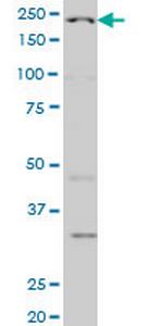 WRN Monoclonal Antibody (3C11)