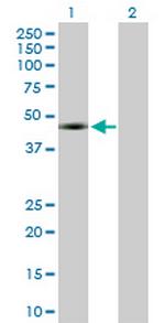 WT1 Polyclonal Antibody, MaxPab™
