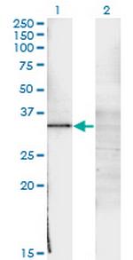 WT1 Monoclonal Antibody (3B12)