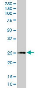 XBP1 Monoclonal Antibody (2D9)