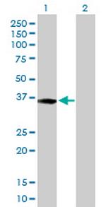 XPA Antibody in Western Blot (WB)