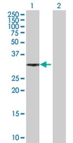 XRCC2 Polyclonal Antibody, MaxPab™