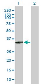 XRCC2 Polyclonal Antibody, MaxPab™