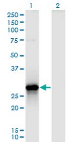 YWHAZ Monoclonal Antibody (5E8)