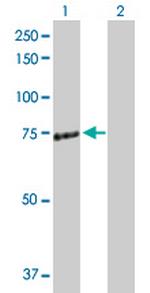 ZAP70 Antibody in Western Blot (WB)